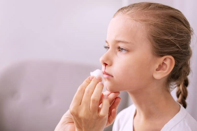 Носовые кровотечения: причины, помощь, профилактика